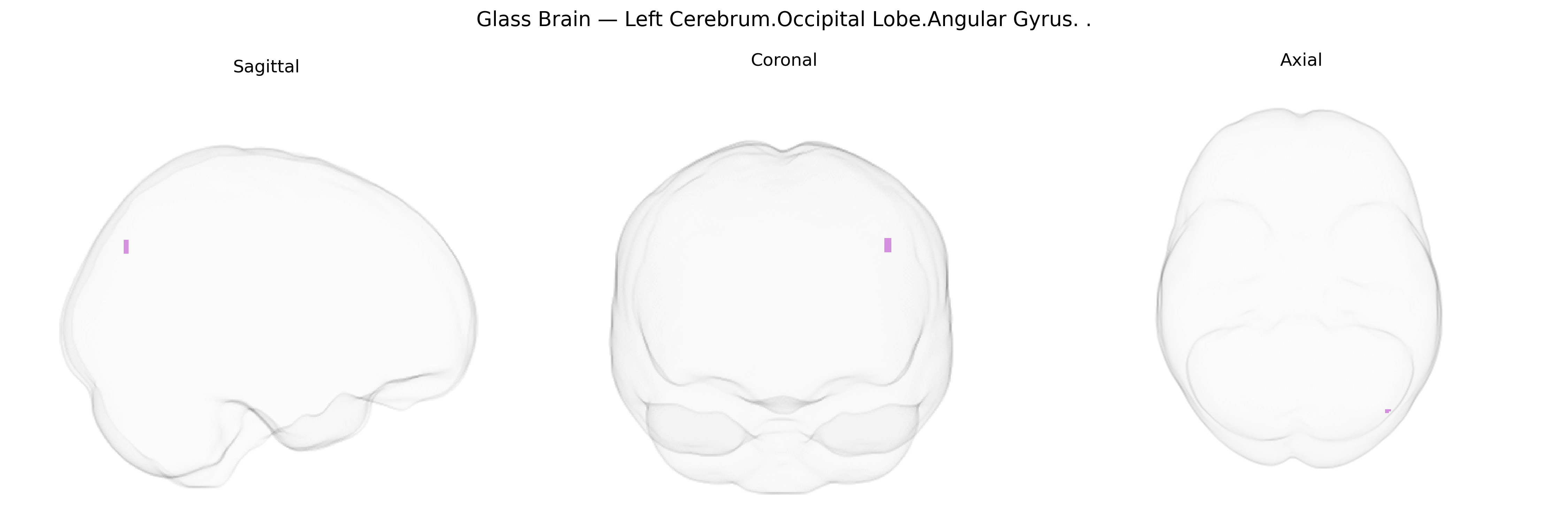 Triplanar Ghost Brain