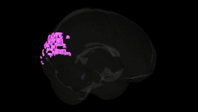 Full Brain Black