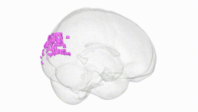 Full Brain White