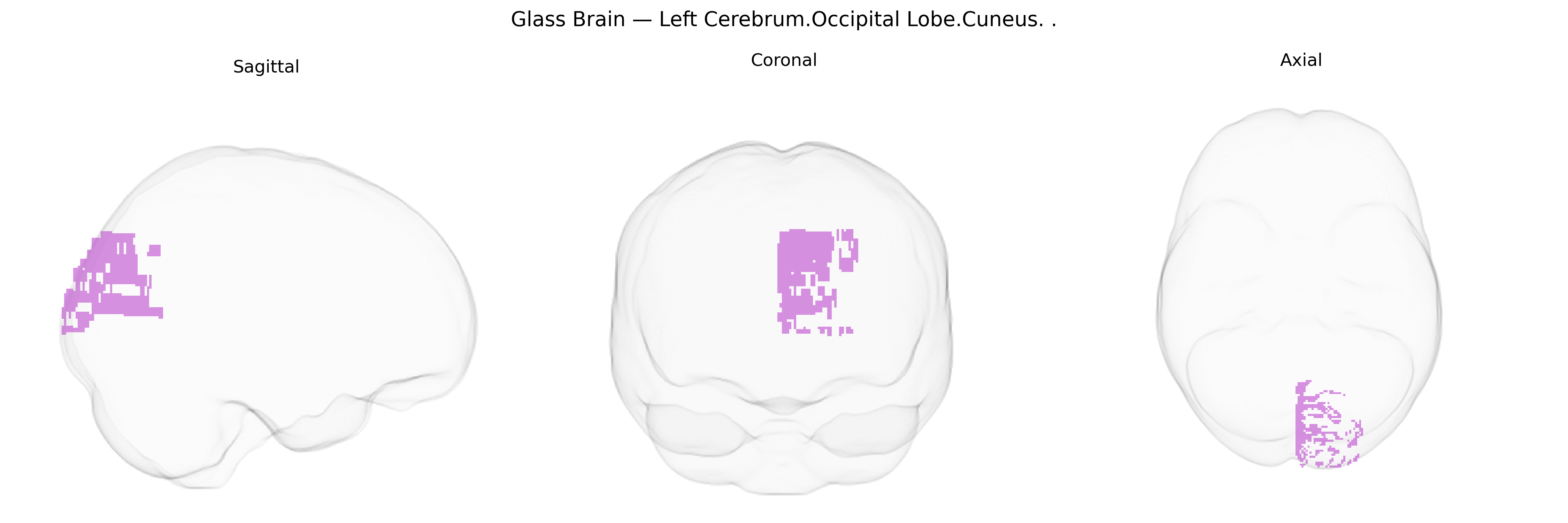 Triplanar Ghost Brain