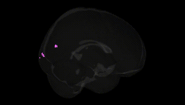 Full Brain Black