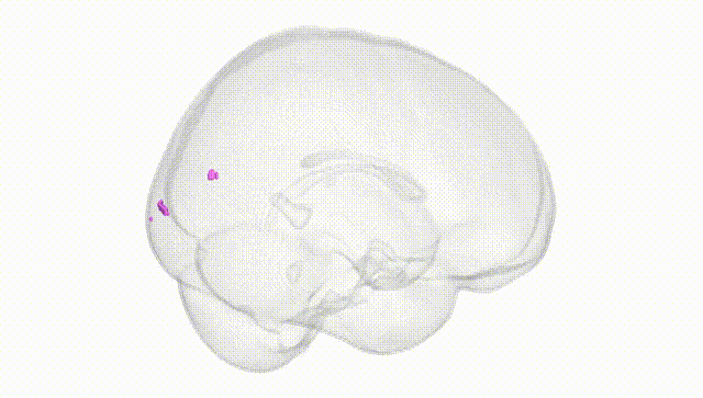 Full Brain White
