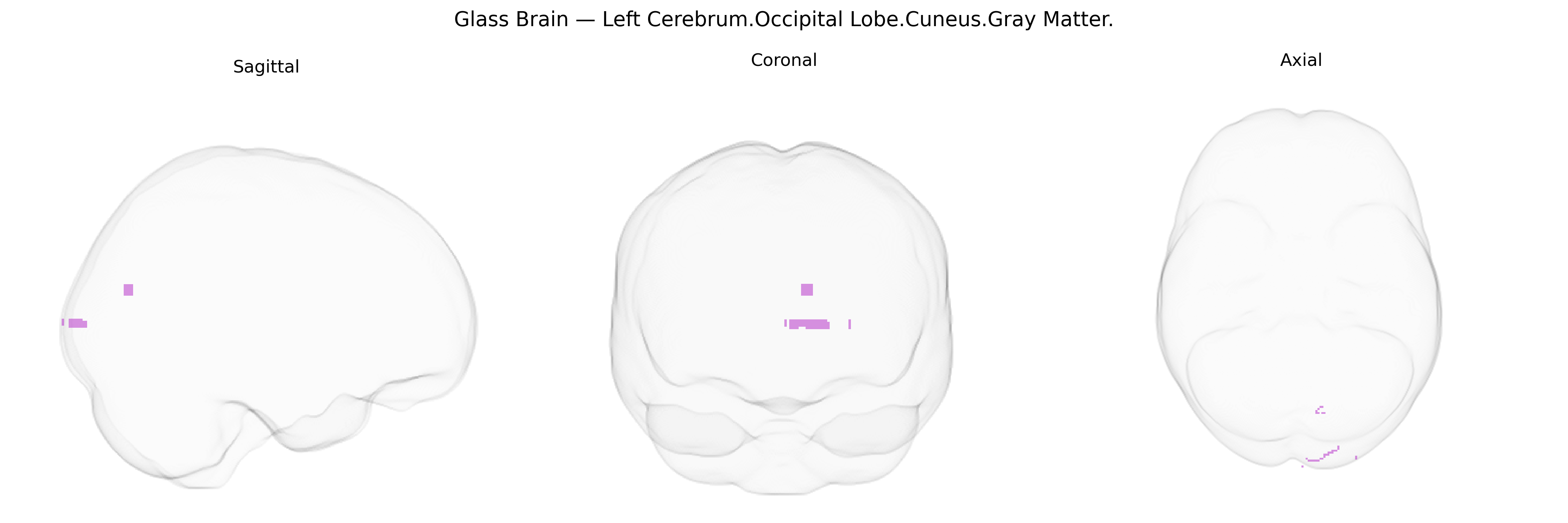 Triplanar Ghost Brain