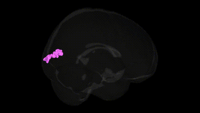 Full Brain Black