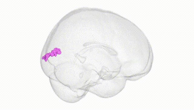 Full Brain White