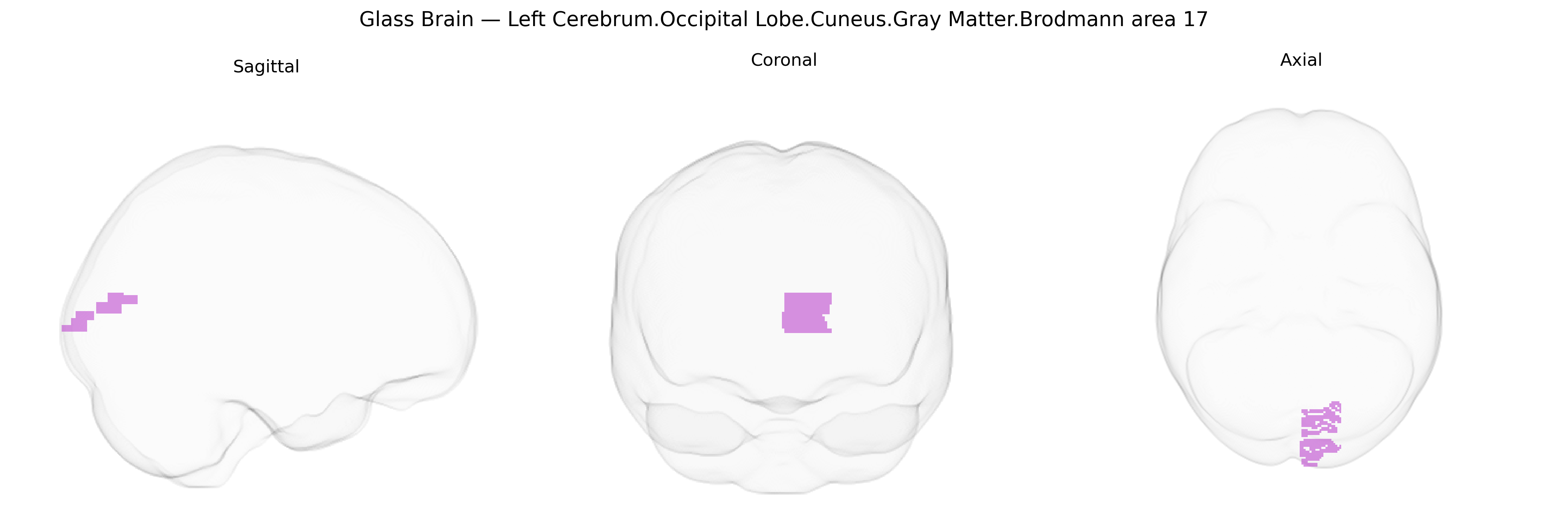 Triplanar Ghost Brain