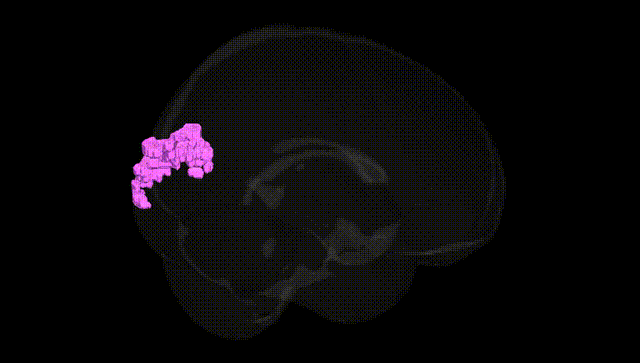 Full Brain Black