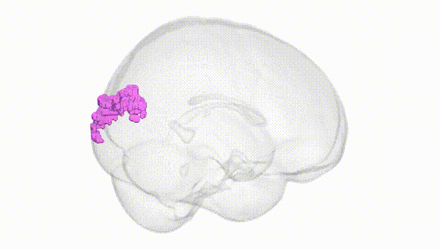 Full Brain White