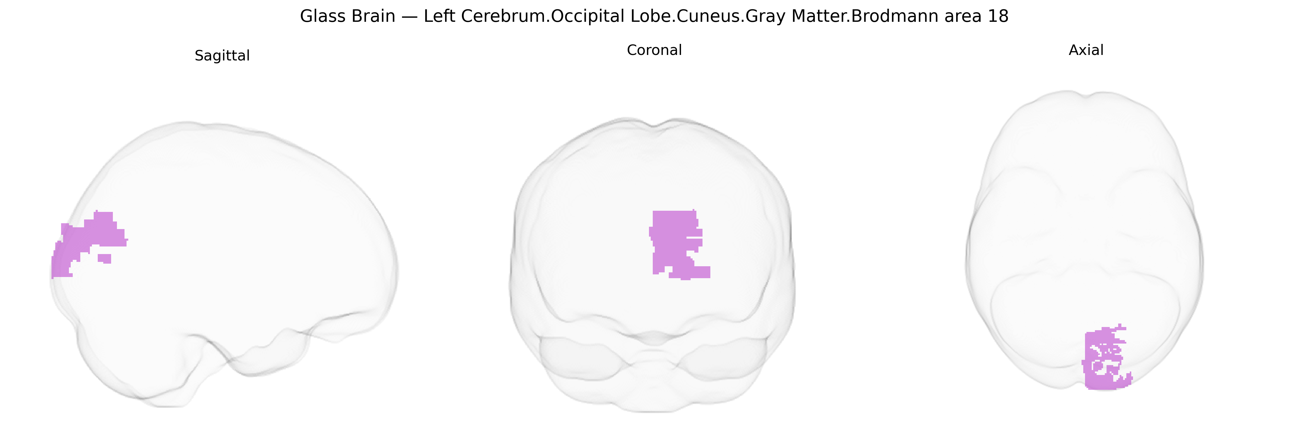 Triplanar Ghost Brain