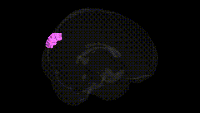 Full Brain Black