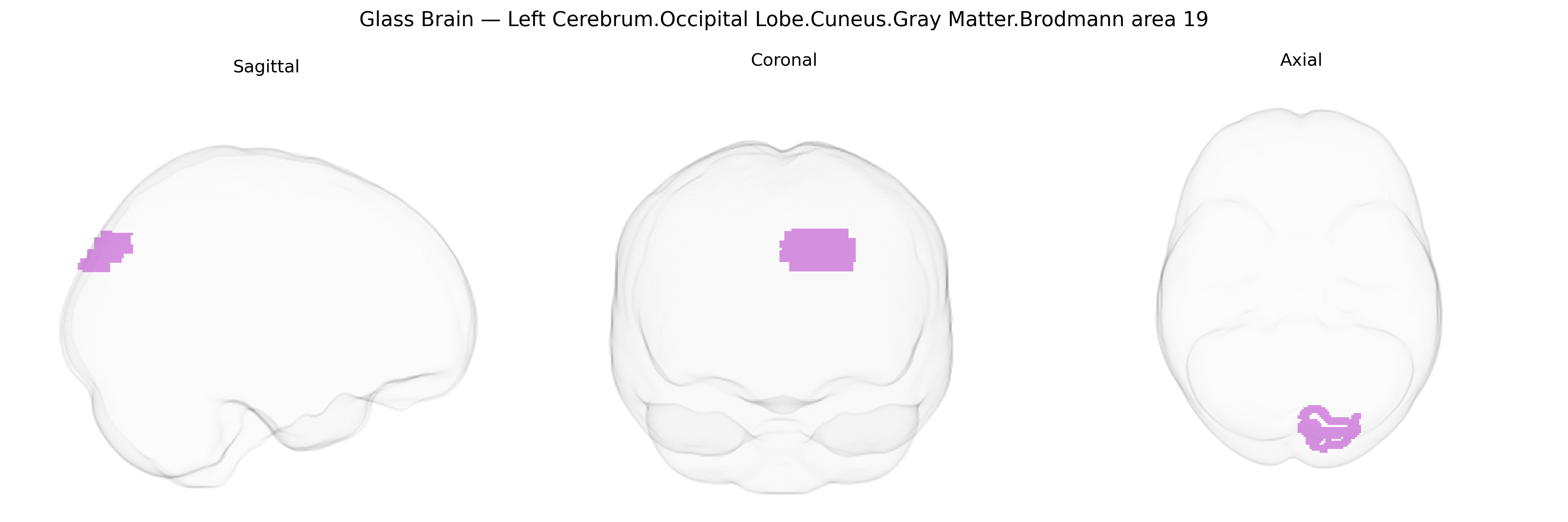 Triplanar Ghost Brain