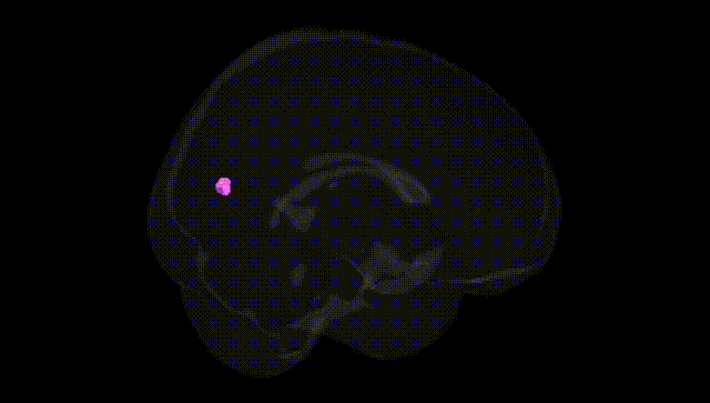 Full Brain Black
