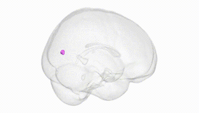 Full Brain White
