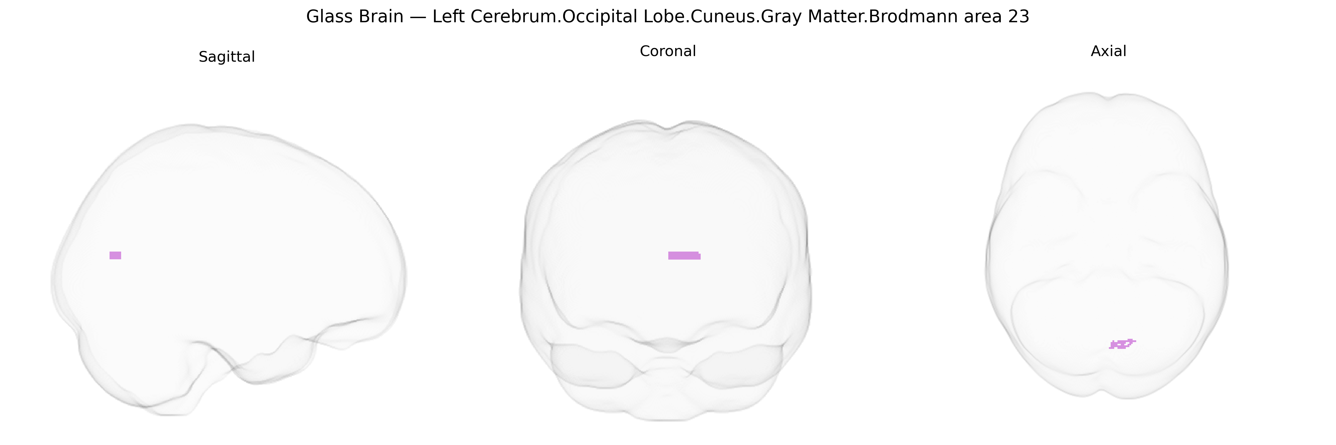 Triplanar Ghost Brain