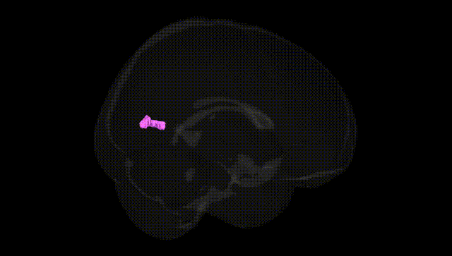 Full Brain Black