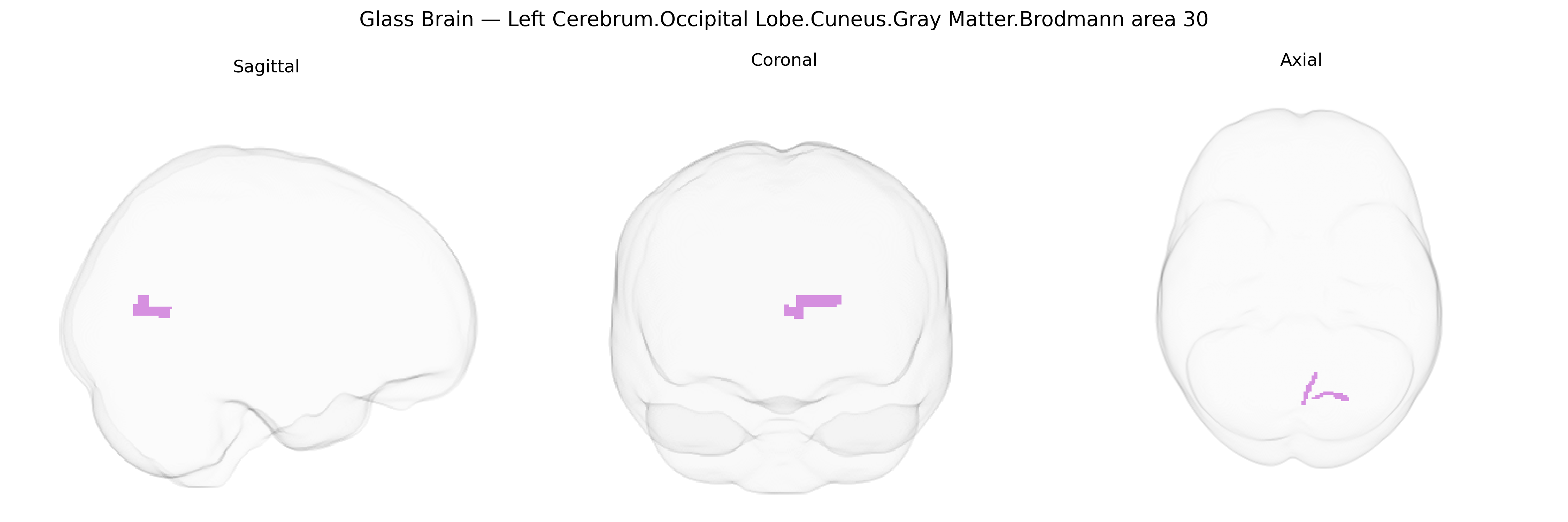 Triplanar Ghost Brain