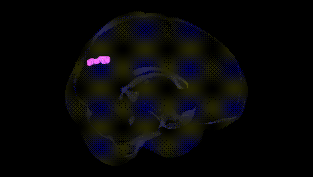 Full Brain Black