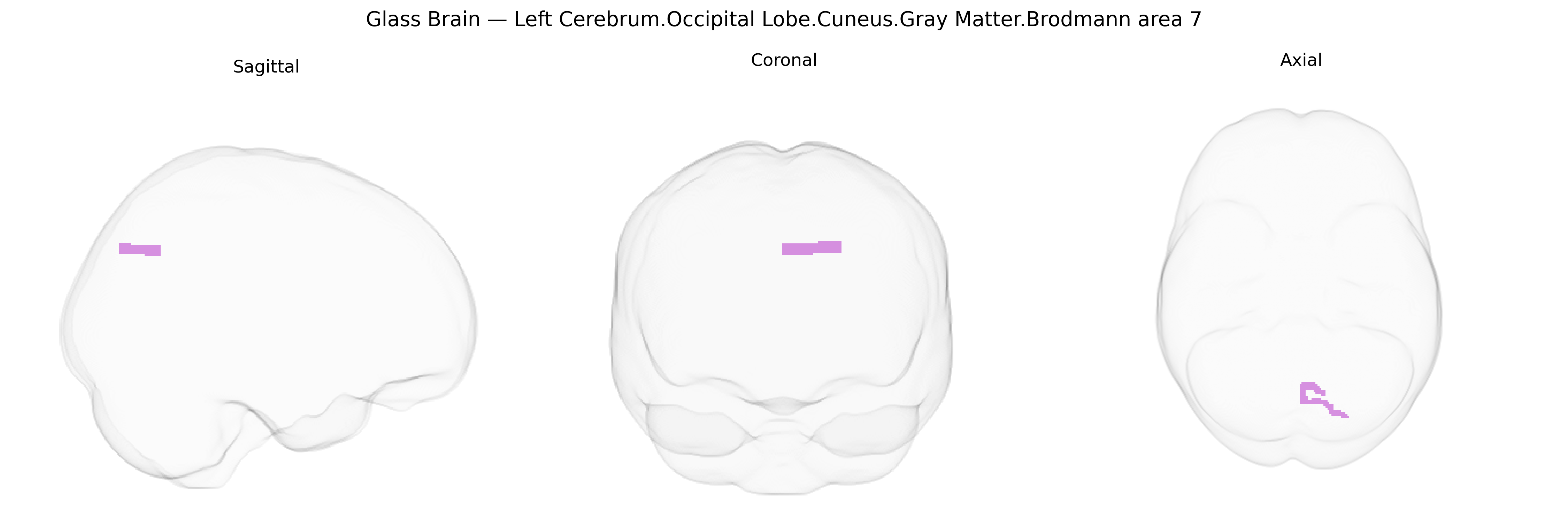 Triplanar Ghost Brain