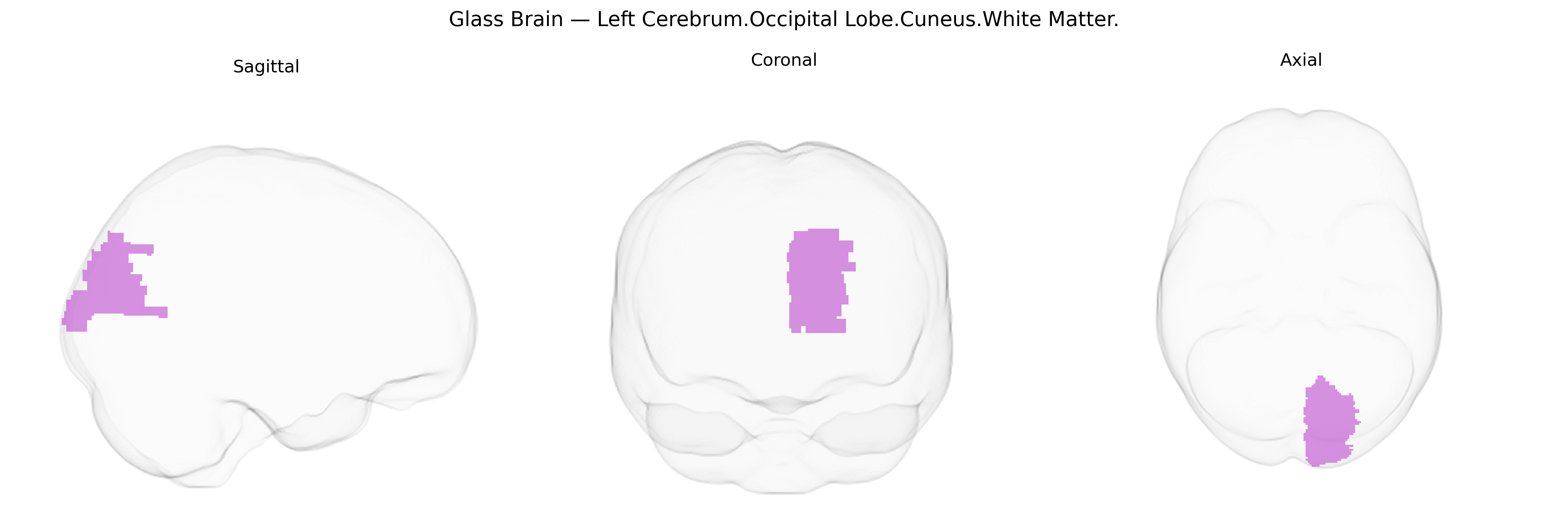 Triplanar Ghost Brain