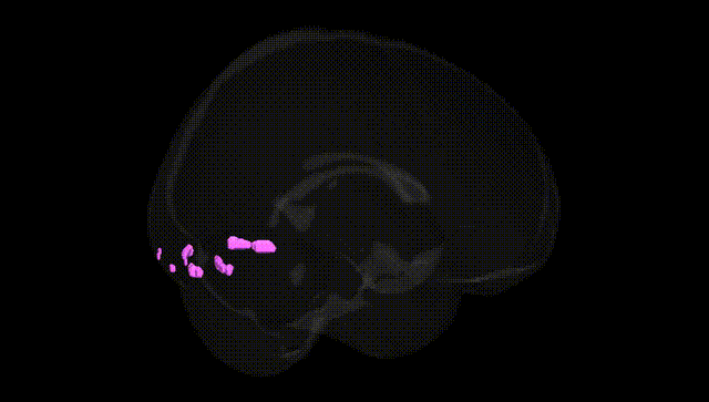 Full Brain Black