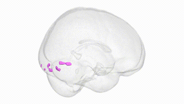 Full Brain White