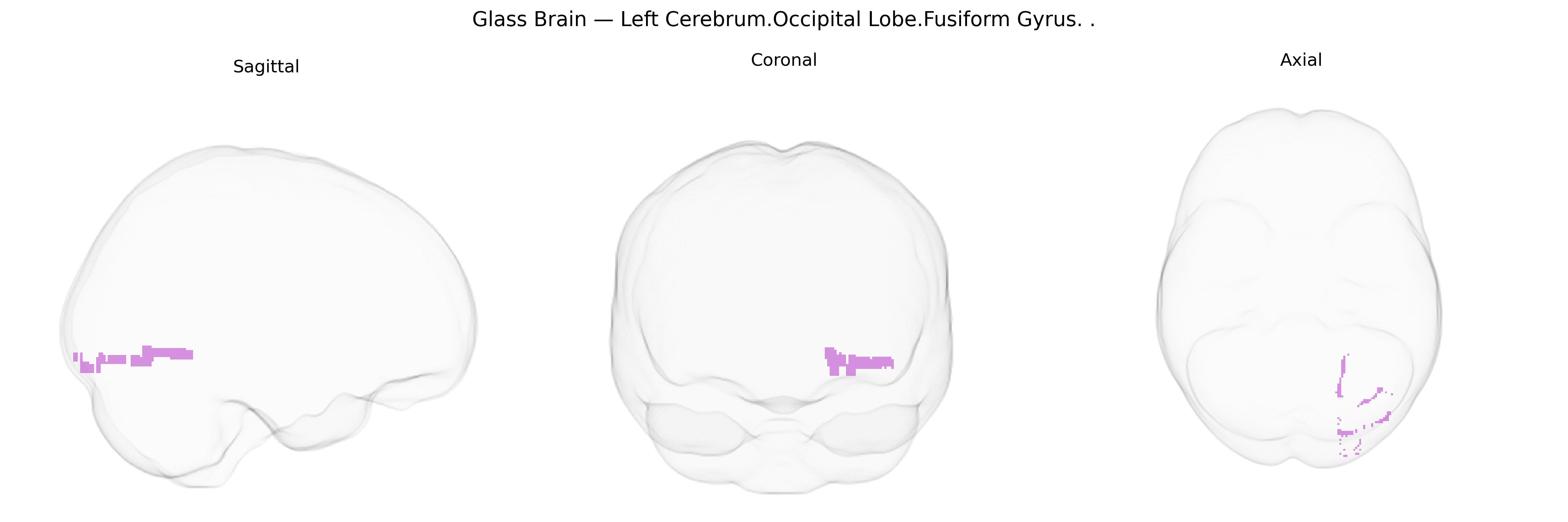 Triplanar Ghost Brain