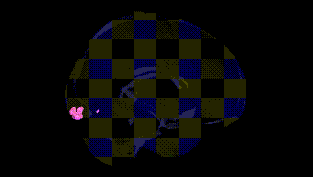 Full Brain Black