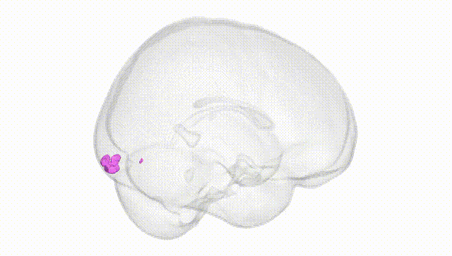 Full Brain White