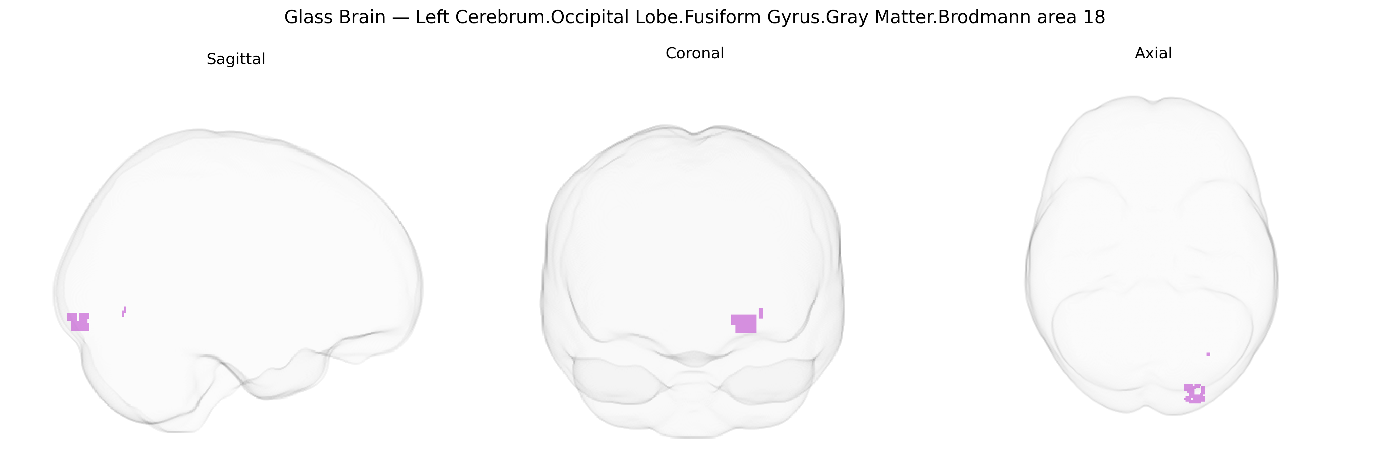Triplanar Ghost Brain