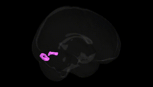 Full Brain Black