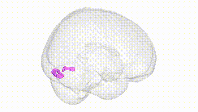 Full Brain White