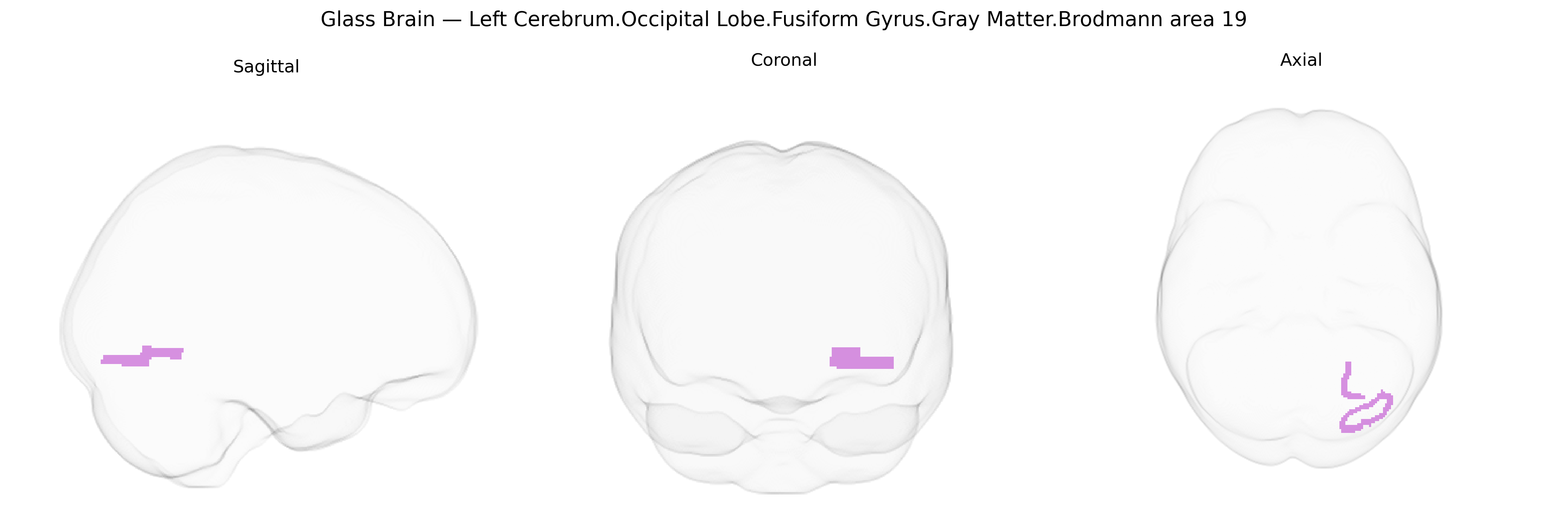 Triplanar Ghost Brain