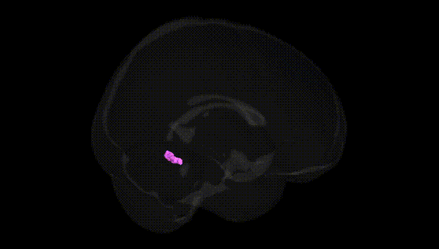 Full Brain Black