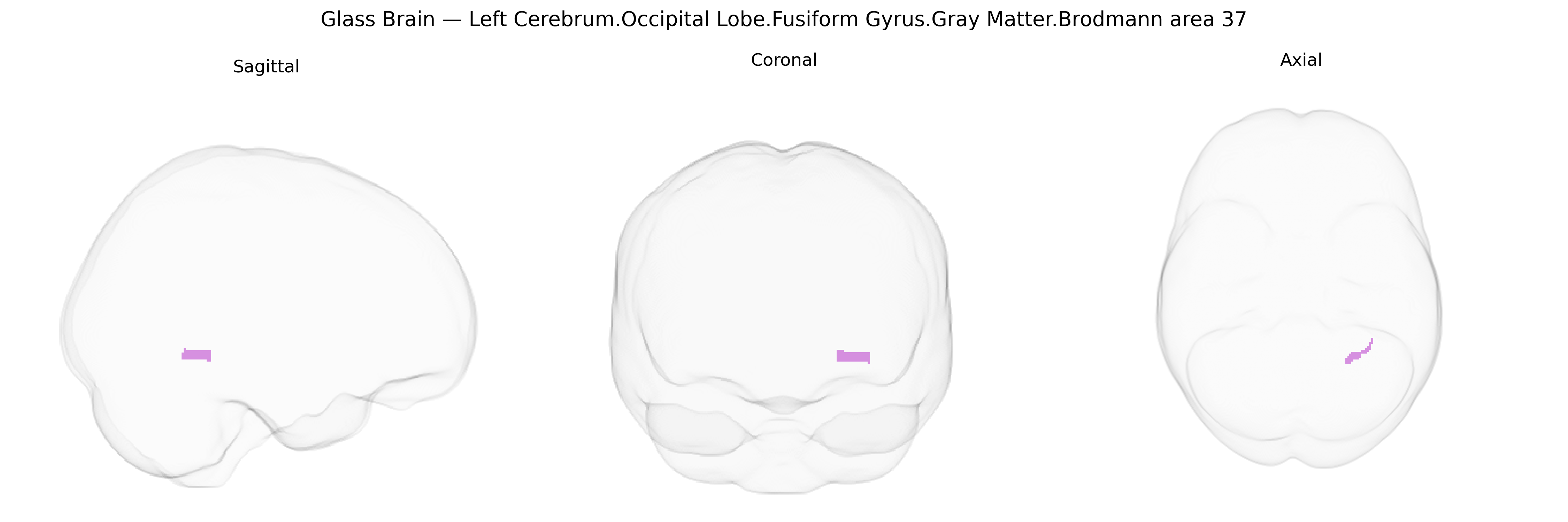 Triplanar Ghost Brain