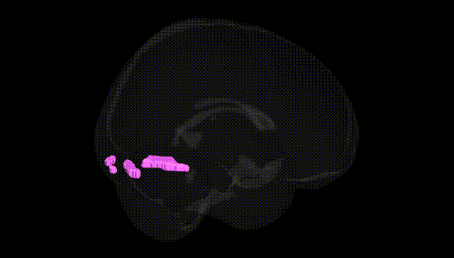 Full Brain Black