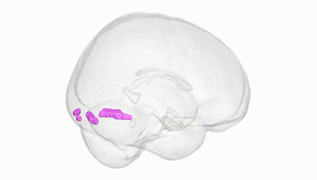 Full Brain White