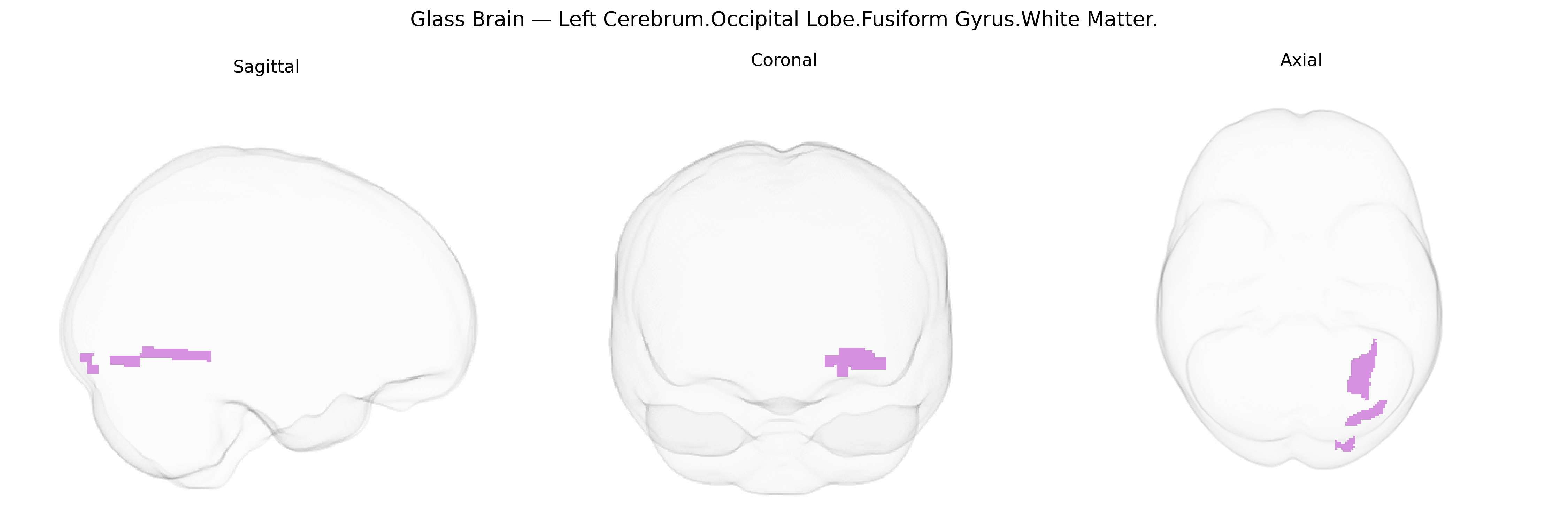 Triplanar Ghost Brain