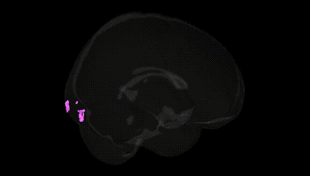 Full Brain Black