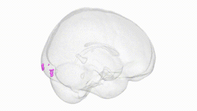 Full Brain White