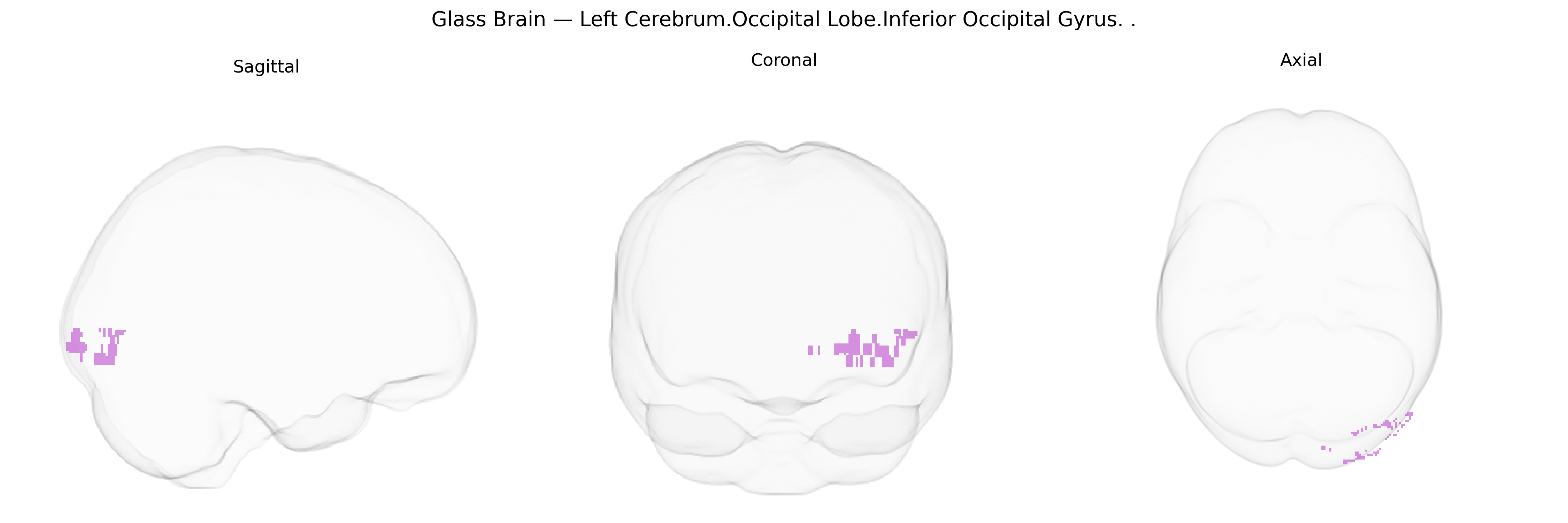 Triplanar Ghost Brain