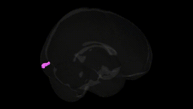 Full Brain Black