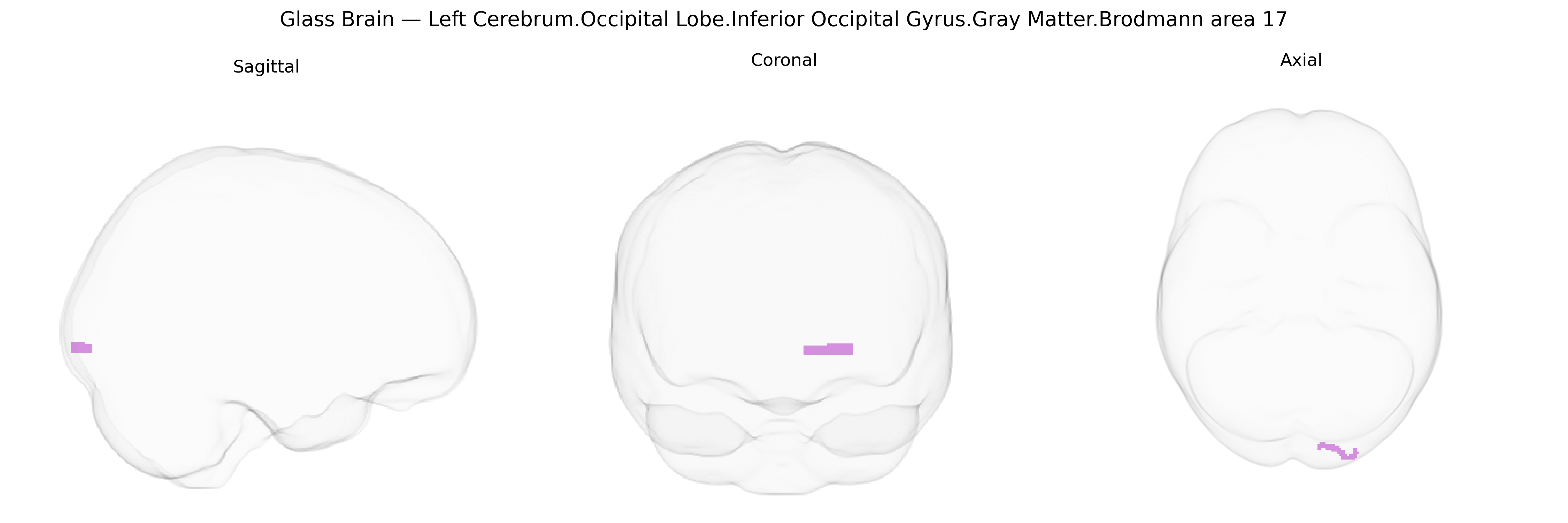 Triplanar Ghost Brain