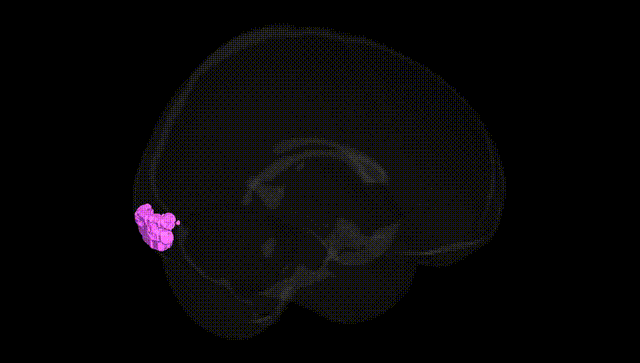 Full Brain Black