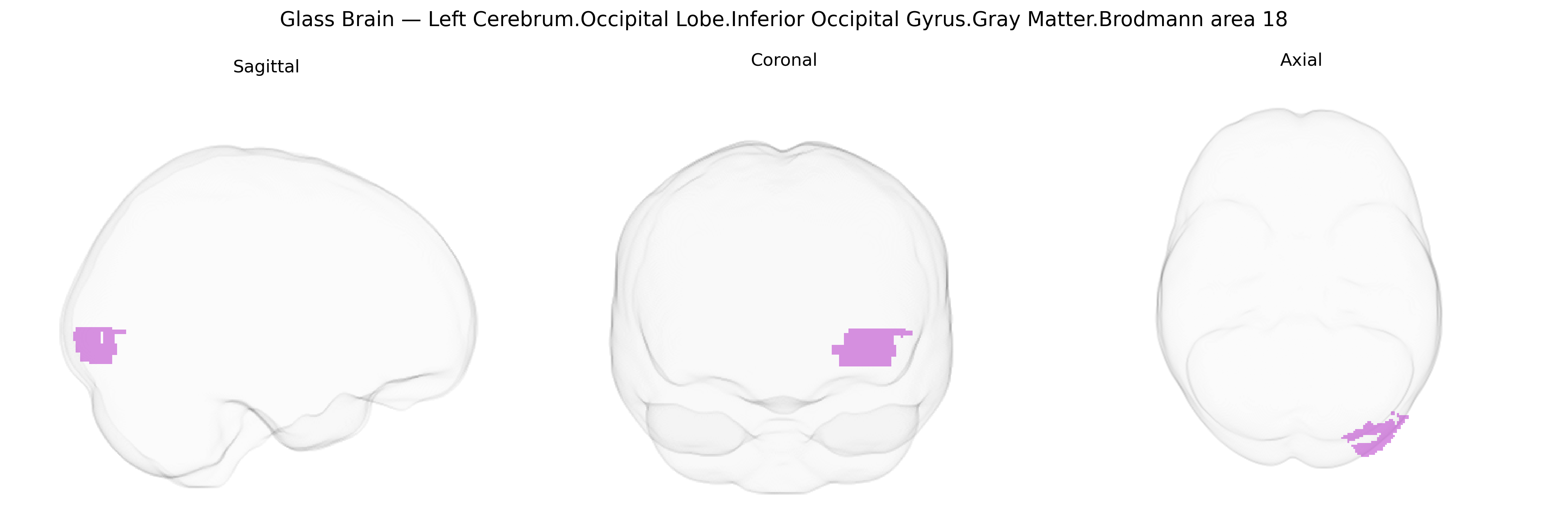 Triplanar Ghost Brain