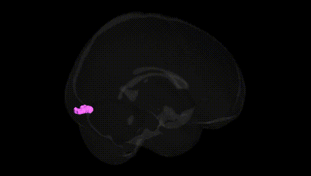 Full Brain Black