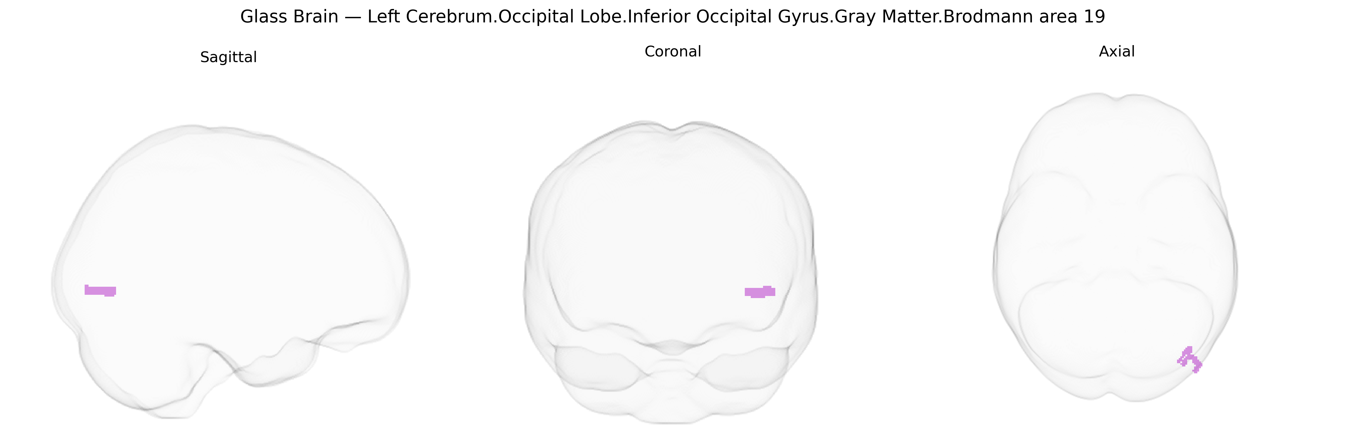 Triplanar Ghost Brain