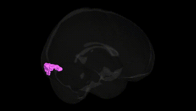 Full Brain Black