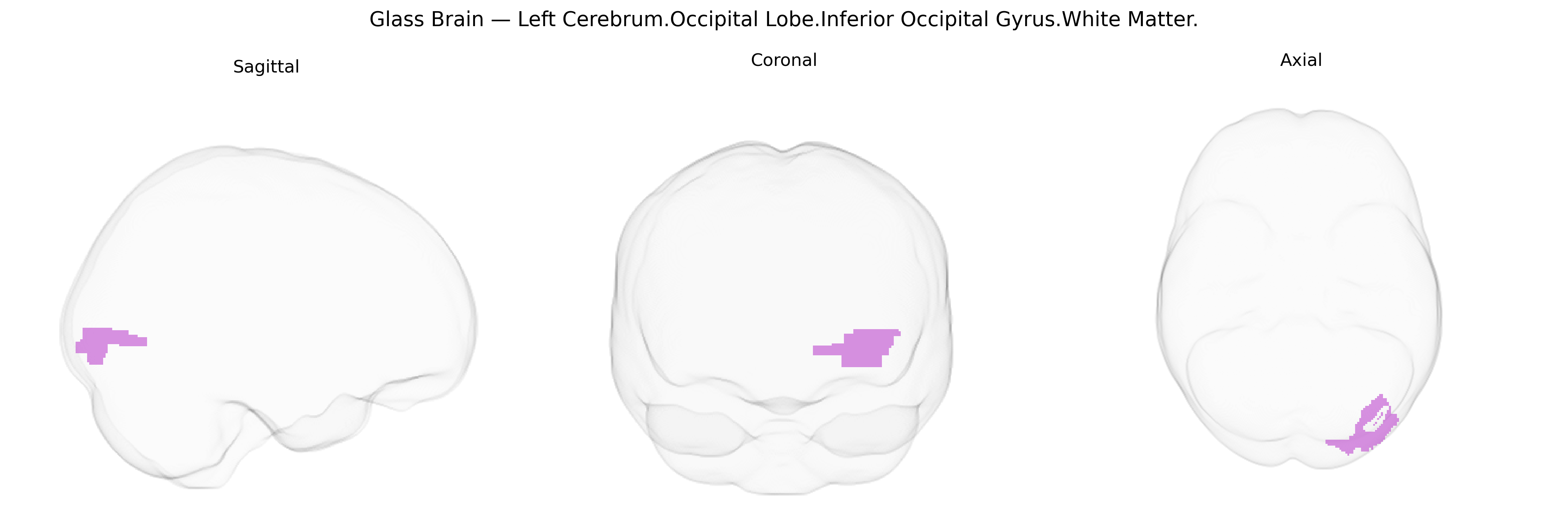 Triplanar Ghost Brain