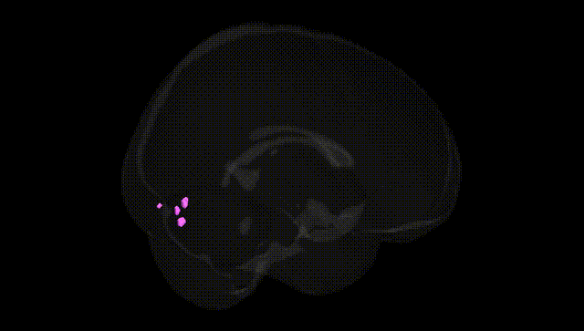 Full Brain Black