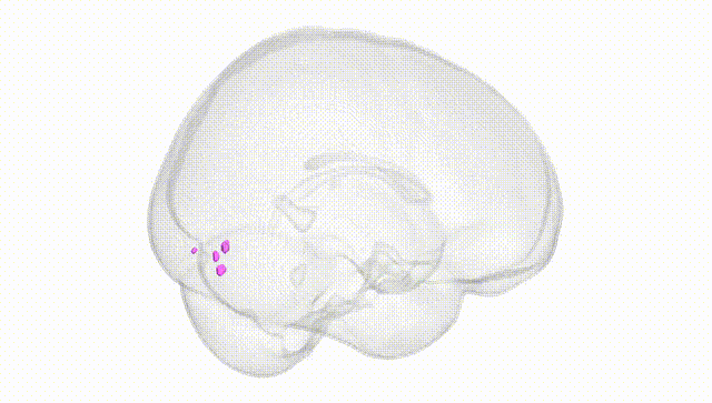 Full Brain White